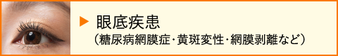 眼底疾患(糖尿病網膜症・黄斑変性・網膜剥離など)